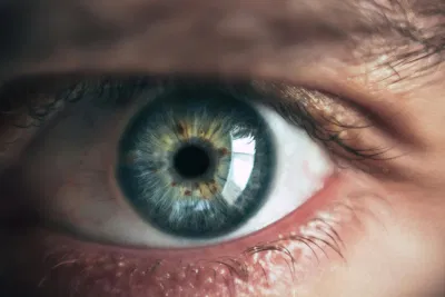 صورة توضيحية لخدمة زراعة القرنية