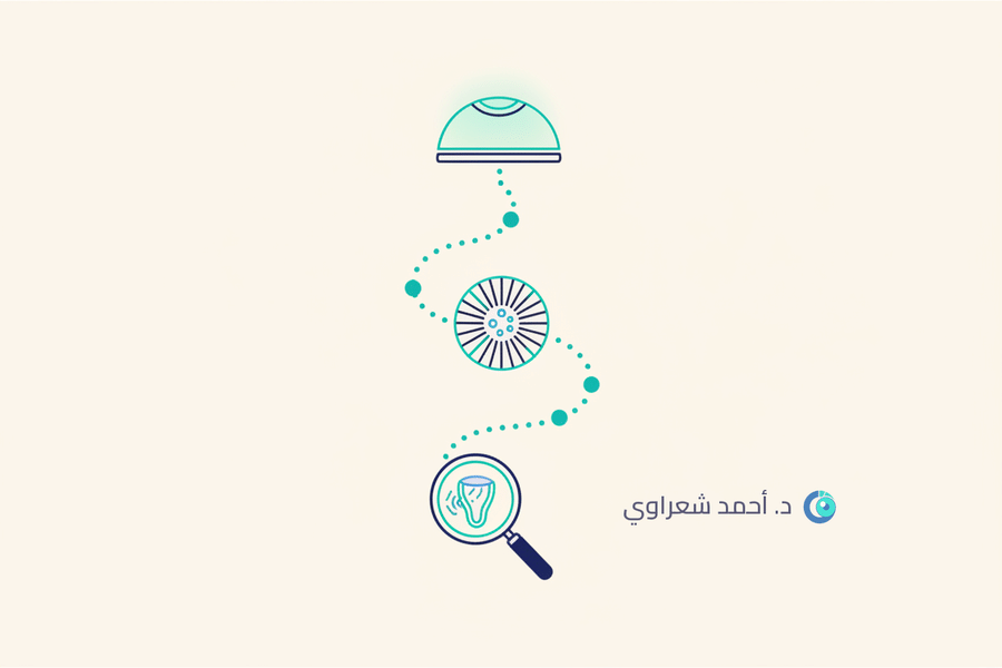 رحلة المريض مع زراعة القرنية: من التشخيص حتى الشفاء الكامل رحلة المريض مع زراعة القرنية: من التشخيص حتى الشفاء الكامل
