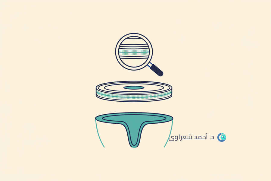 تكلفة عملية زراعة القرنية في مصر: كل ما تحتاج معرفته قبل القرار تكلفة عملية زراعة القرنية في مصر: كل ما تحتاج معرفته قبل القرار
