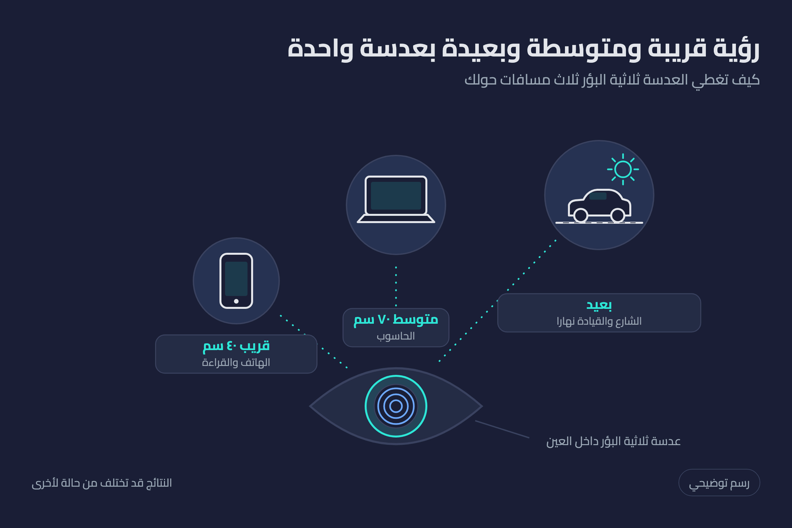 رسم توضيحي لمسافات الرؤية الثلاث مع العدسة ثلاثية البؤر: قريب ٤٠ سم ومتوسط ٧٠ سم وبعيد